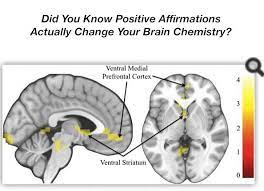 Affirmations and the brain